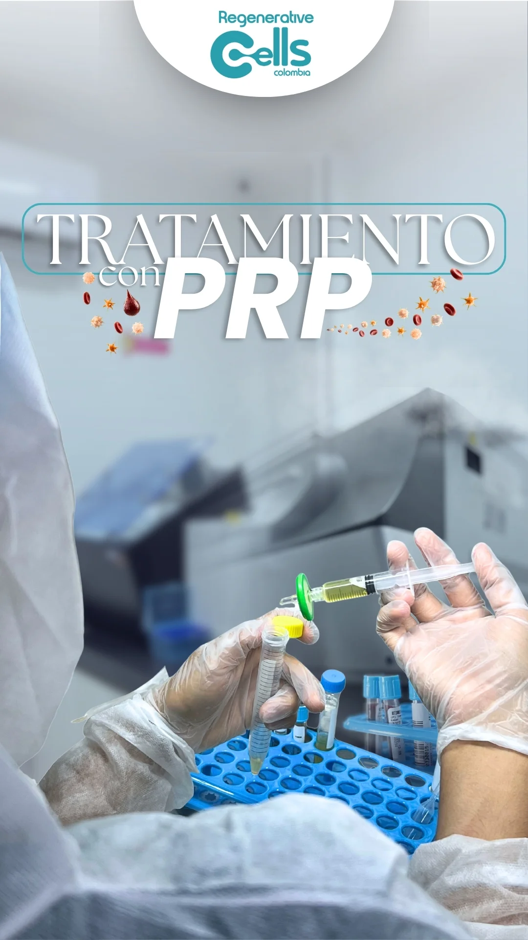 Tratamiento con PRP